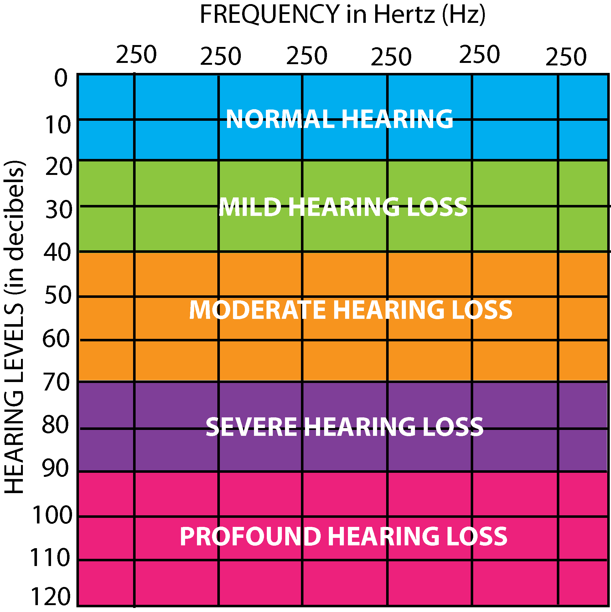 Hearing Levels Audiogram